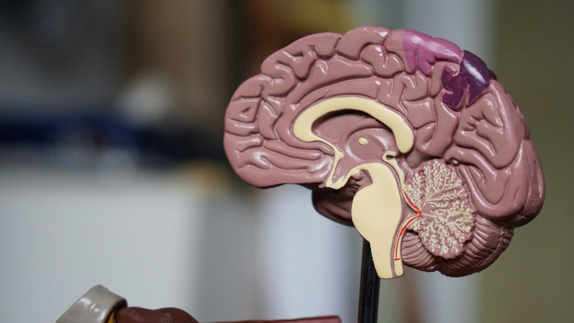 Who Is Most at Risk for Dementia? 5 Small Things That Can Have a Huge Impact on Brain Health
